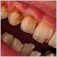 gum disease dentist nyc