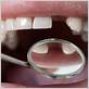 gum disease dentist ryde