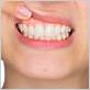 gum disease dentist sacramento ca