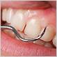 gum disease dentist san diego