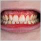 gum disease dentist seattle wa