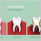 gum disease denver