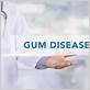 gum disease des moines ia