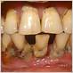gum disease diane tarica