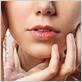 gum disease dry lips