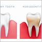 gum disease edmonds wa