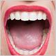 gum disease excess saliva