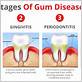 gum disease fatigue