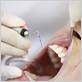 gum disease fix top ryde