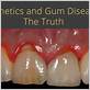 gum disease genetic predisposition