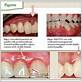 gum disease harley street