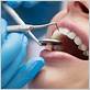 gum disease havasu az