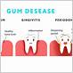 gum disease hearing