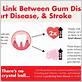 gum disease heart attack link