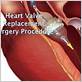 gum disease heart valve replacement