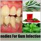 gum disease herbs bacteria
