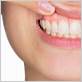 gum disease houston tx