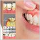 gum disease in cary