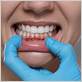 gum disease in columbus