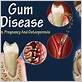 gum disease in pregnancy