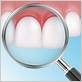 gum disease in san rafael