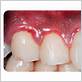 gum disease in summerlin nv