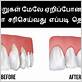 gum disease in tamil