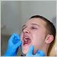 gum disease in young adults