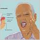 gum disease jawbone