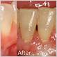 gum disease kansas city mo