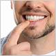 gum disease laguna beach ca