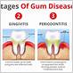 gum disease menlo park ca