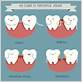 gum disease methods of cute