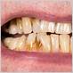 gum disease midtown manhattan
