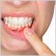 gum disease montréal
