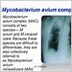 gum disease mycobacterium avium complex