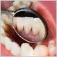 gum disease naples fl
