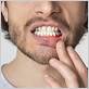 gum disease nashville tn