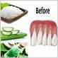 gum disease natural treatment remedy