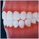 gum disease new braunfels tx