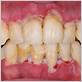 gum disease north hampton nh