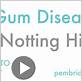 gum disease notting hill