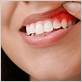 gum disease nottingham