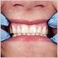 gum disease nw calgary