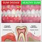 gum disease oshawa on