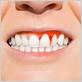 gum disease other health problems