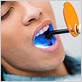 gum disease payson