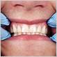 gum disease pictures what do healthy gums look like crestcrest