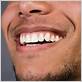 gum disease pleasanton