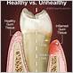 gum disease port salerno fl